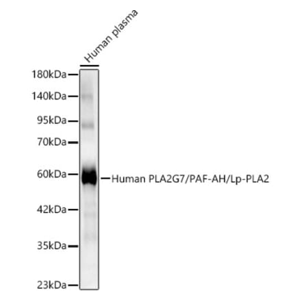 Western Blot - Anti-PLA2G7 Antibody (A329754) - Antibodies.com