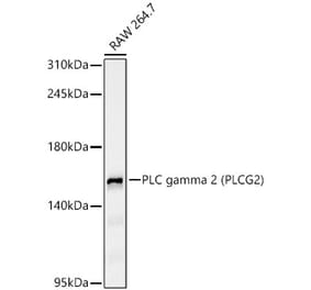 Western Blot - Anti-PLCG 2 Antibody [ARC65255] (A329755) - Antibodies.com