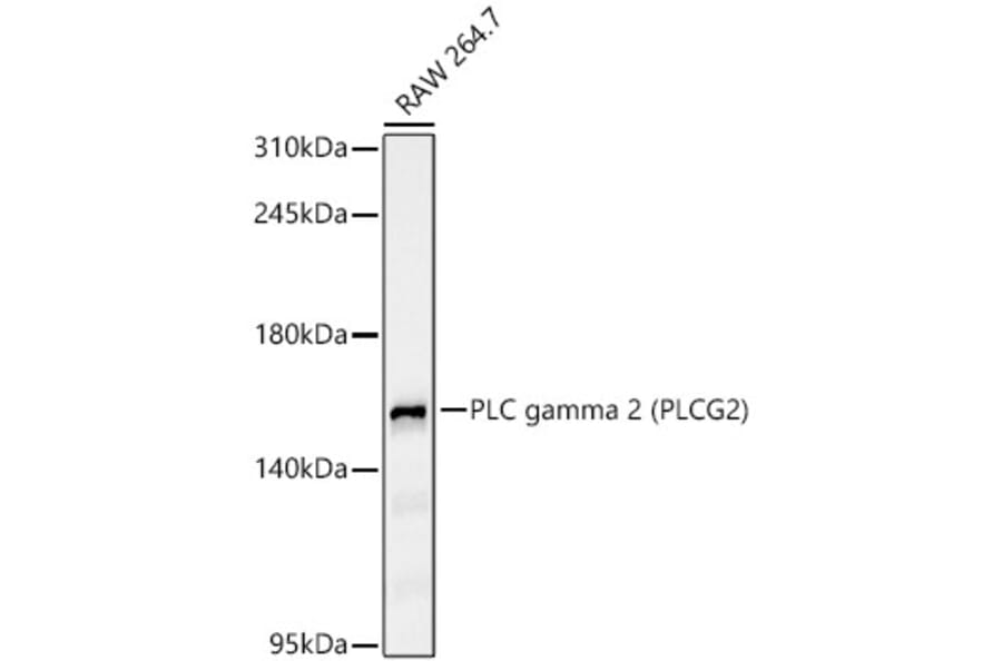 Western Blot - Anti-PLCG 2 Antibody [ARC65255] (A329755) - Antibodies.com