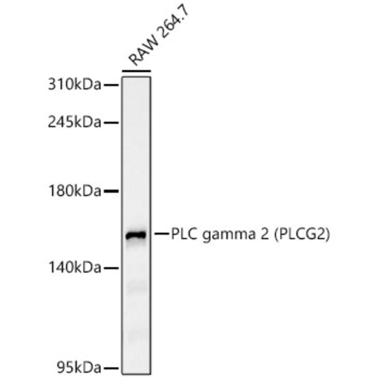 Western Blot - Anti-PLCG 2 Antibody [ARC65255] (A329755) - Antibodies.com