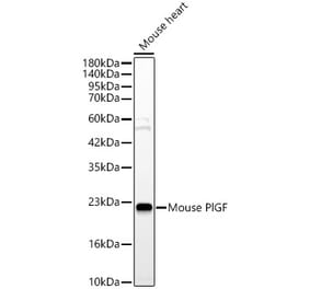 Western Blot - Anti-PLGF Antibody (A329757) - Antibodies.com