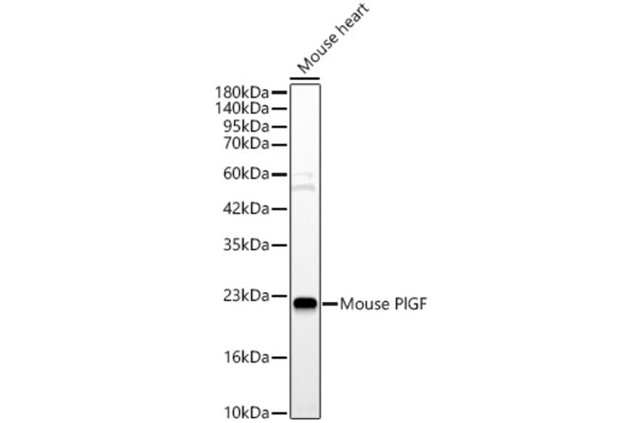 Western Blot - Anti-PLGF Antibody (A329757) - Antibodies.com