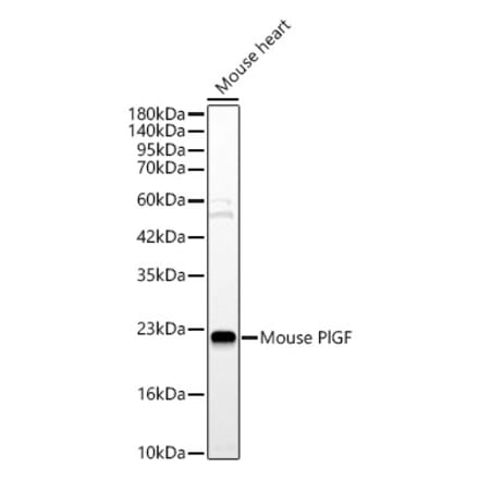 Western Blot - Anti-PLGF Antibody (A329757) - Antibodies.com