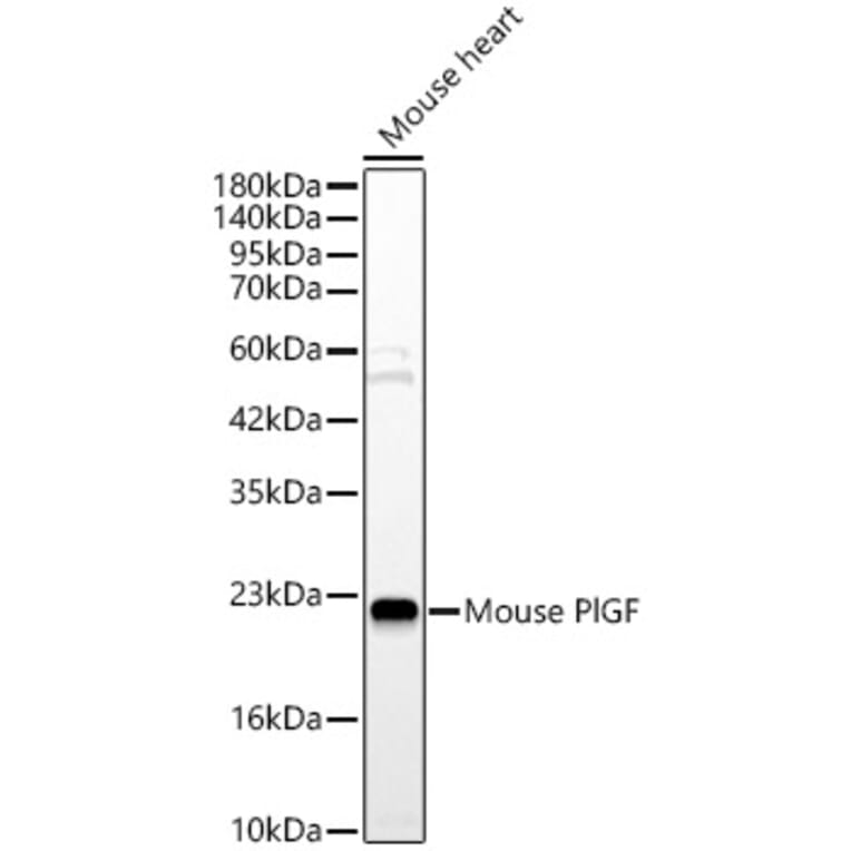 Western Blot - Anti-PLGF Antibody (A329757) - Antibodies.com