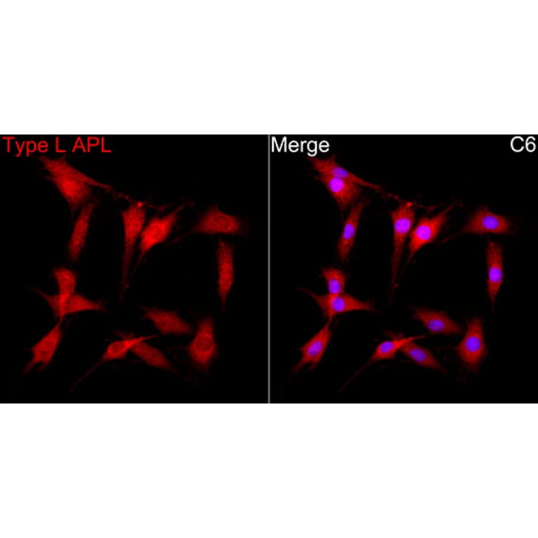 Immunofluorescence - Anti-PML + RARA Antibody (A329759) - Antibodies.com