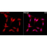 Immunofluorescence - Anti-PML + RARA Antibody (A329759) - Antibodies.com