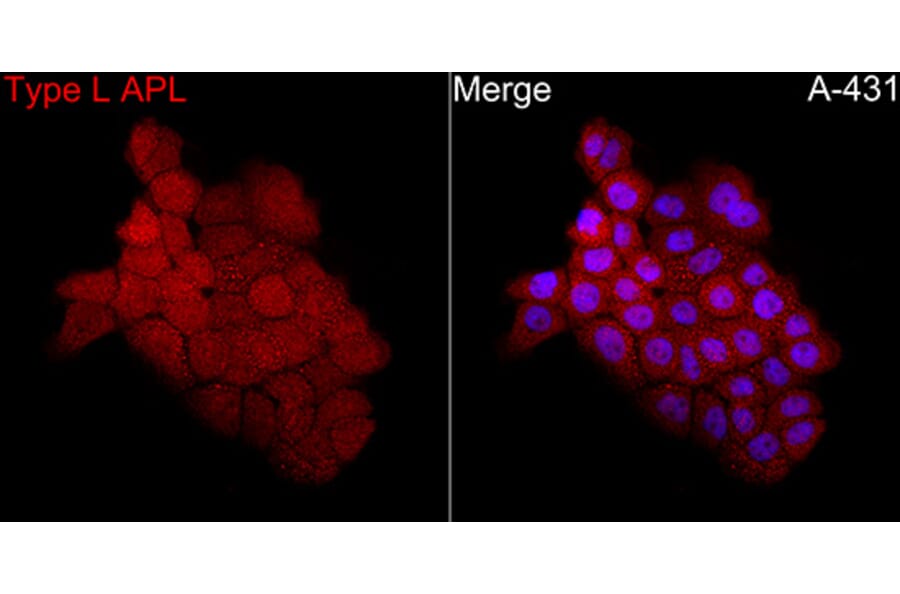 Immunofluorescence - Anti-PML + RARA Antibody (A329759) - Antibodies.com