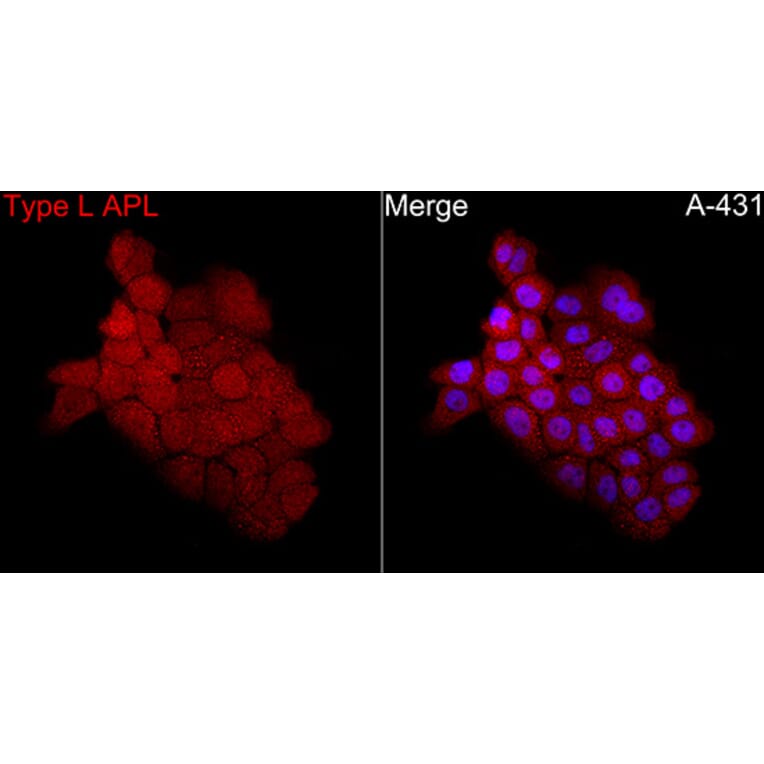 Immunofluorescence - Anti-PML + RARA Antibody (A329759) - Antibodies.com
