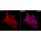 Immunofluorescence - Anti-PML + RARA Antibody (A329759) - Antibodies.com