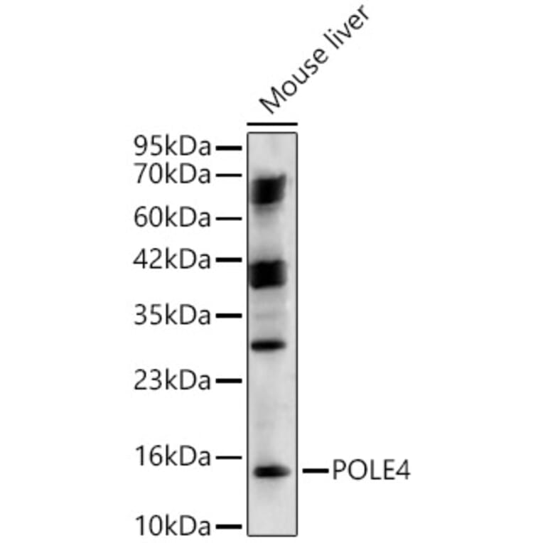 Western Blot - Anti-POLE4 Antibody (A329761) - Antibodies.com
