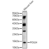 Western Blot - Anti-POLE4 Antibody (A329761) - Antibodies.com