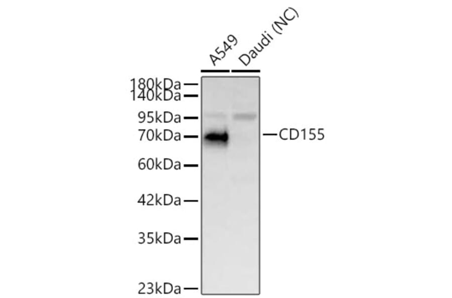 Western Blot - Anti-PVR Antibody (A329762) - Antibodies.com