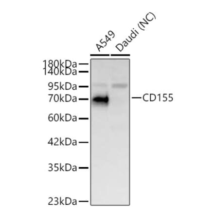 Western Blot - Anti-PVR Antibody (A329762) - Antibodies.com