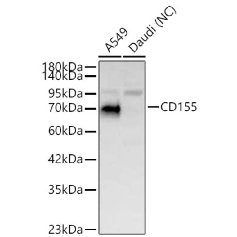 Western Blot - Anti-PVR Antibody (A329762) - Antibodies.com
