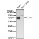 Western Blot - Anti-PVR Antibody (A329762) - Antibodies.com