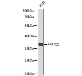 Western Blot - Anti-PP1C gamma Antibody (A329763) - Antibodies.com