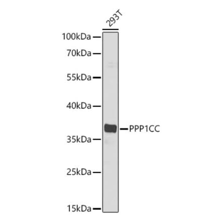 Western Blot - Anti-PP1C gamma Antibody (A329763) - Antibodies.com