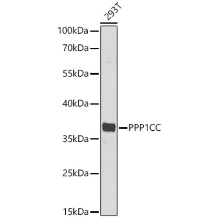 Western Blot - Anti-PP1C gamma Antibody (A329763) - Antibodies.com