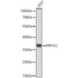 Western Blot - Anti-PP1C gamma Antibody (A329763) - Antibodies.com