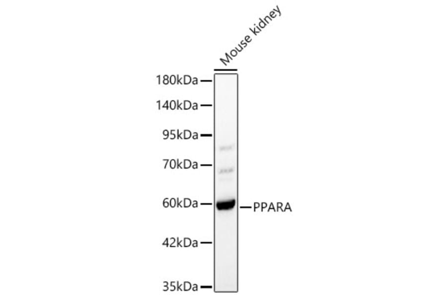 Western Blot - Anti-PPAR alpha Antibody (A329764) - Antibodies.com