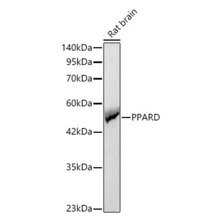 Western Blot - Anti-PPAR delta Antibody (A329765) - Antibodies.com