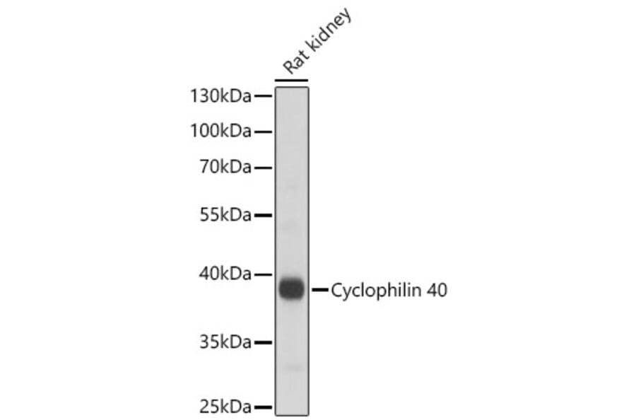 Western Blot - Anti-PPID Antibody (A329766) - Antibodies.com