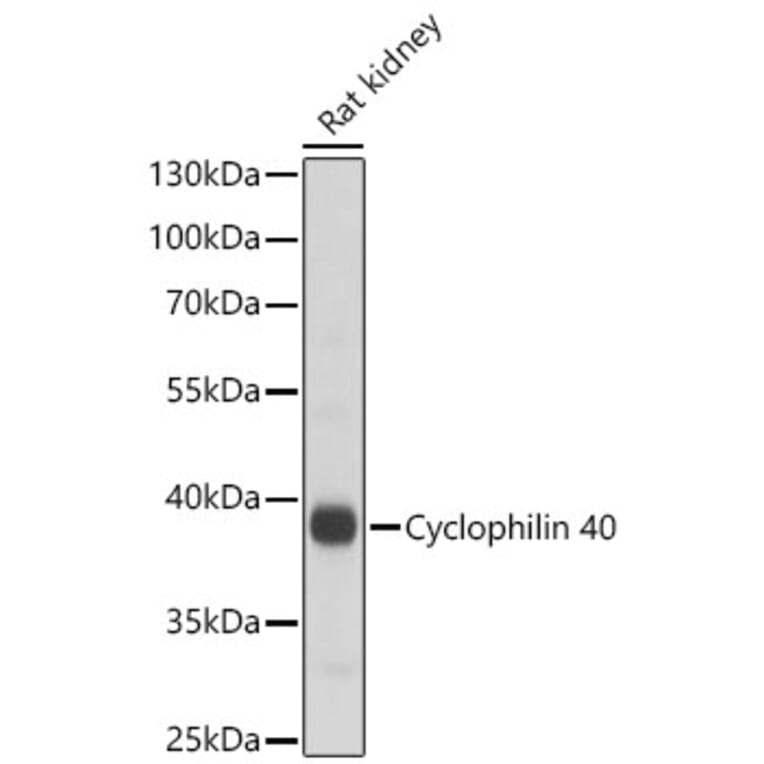 Western Blot - Anti-PPID Antibody (A329766) - Antibodies.com