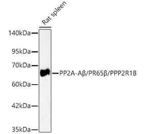 Western Blot - Anti-PPP2R1B Antibody (A329767) - Antibodies.com