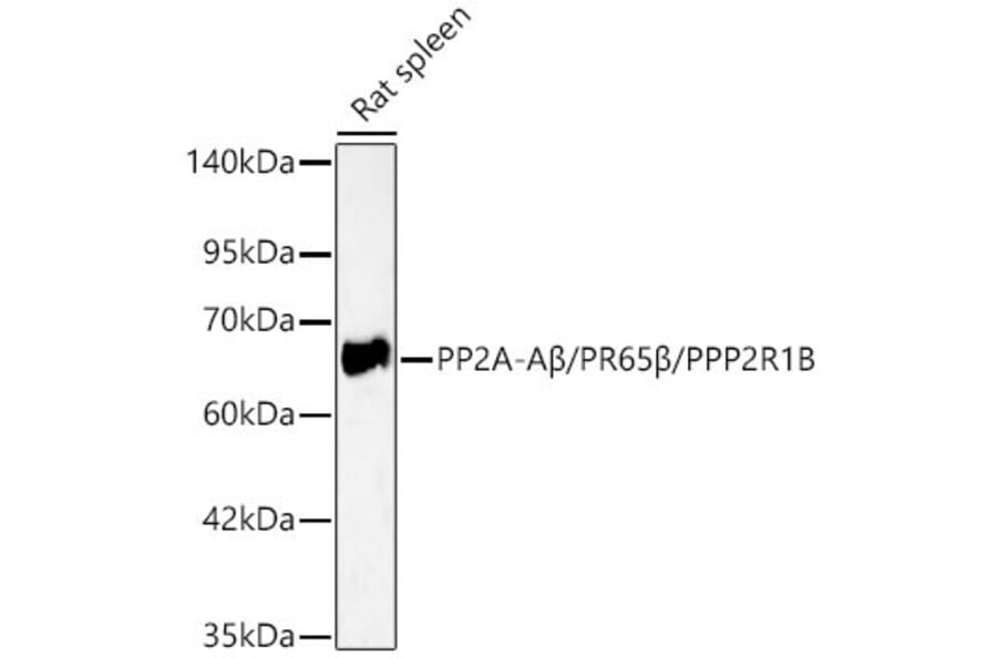 Western Blot - Anti-PPP2R1B Antibody (A329767) - Antibodies.com