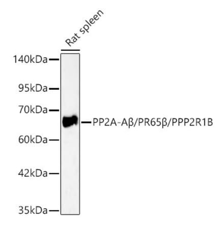 Western Blot - Anti-PPP2R1B Antibody (A329767) - Antibodies.com