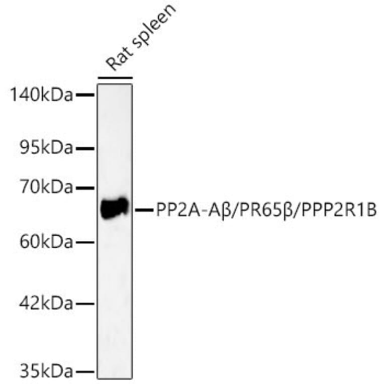 Western Blot - Anti-PPP2R1B Antibody (A329767) - Antibodies.com