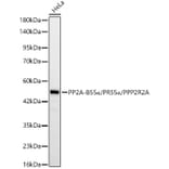 Western Blot - Anti-PPP2R2A Antibody [ARC60262] (A329768) - Antibodies.com
