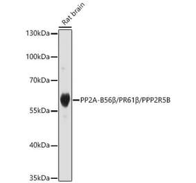 Western Blot - Anti-PPP2R5B Antibody (A329769) - Antibodies.com