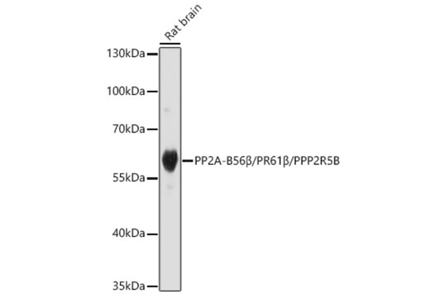 Western Blot - Anti-PPP2R5B Antibody (A329769) - Antibodies.com