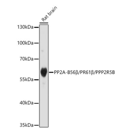 Western Blot - Anti-PPP2R5B Antibody (A329769) - Antibodies.com