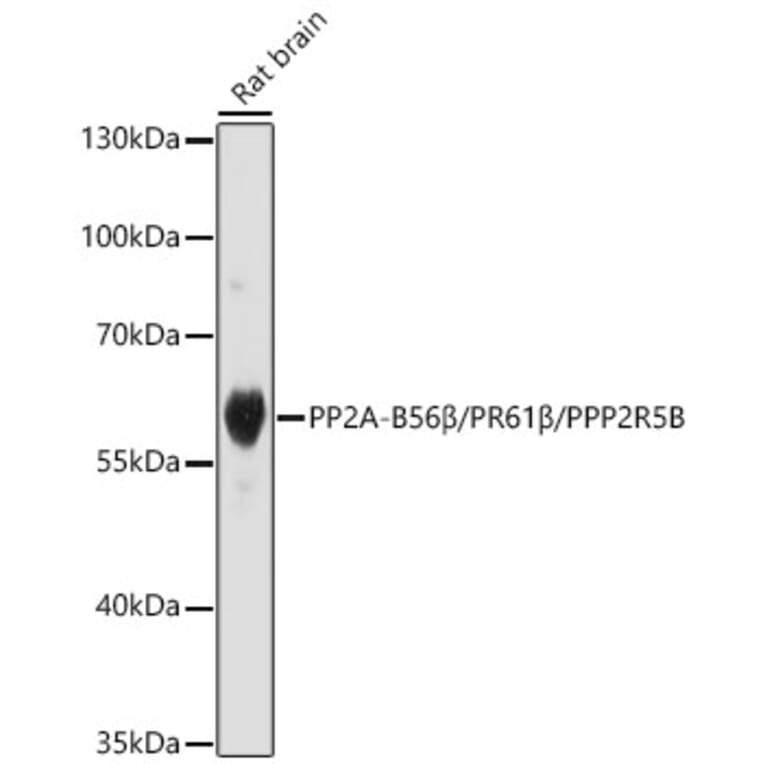 Western Blot - Anti-PPP2R5B Antibody (A329769) - Antibodies.com