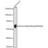 Western Blot - Anti-PPP2R5B Antibody (A329769) - Antibodies.com