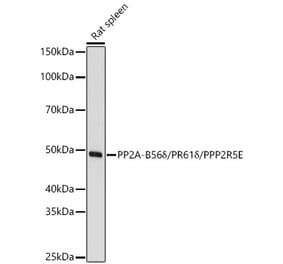 Western Blot - Anti-PPP2R5E Antibody (A329770) - Antibodies.com