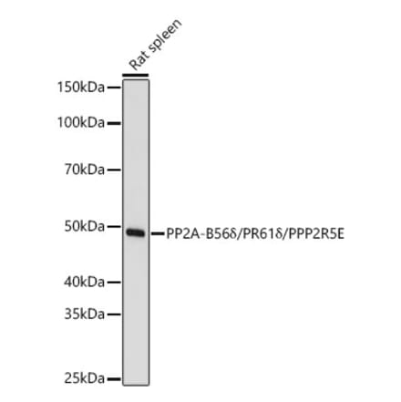 Western Blot - Anti-PPP2R5E Antibody (A329770) - Antibodies.com