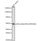 Western Blot - Anti-PPP2R5E Antibody (A329770) - Antibodies.com