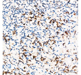 Immunohistochemistry - Anti-PRELID1 Antibody (A329773) - Antibodies.com