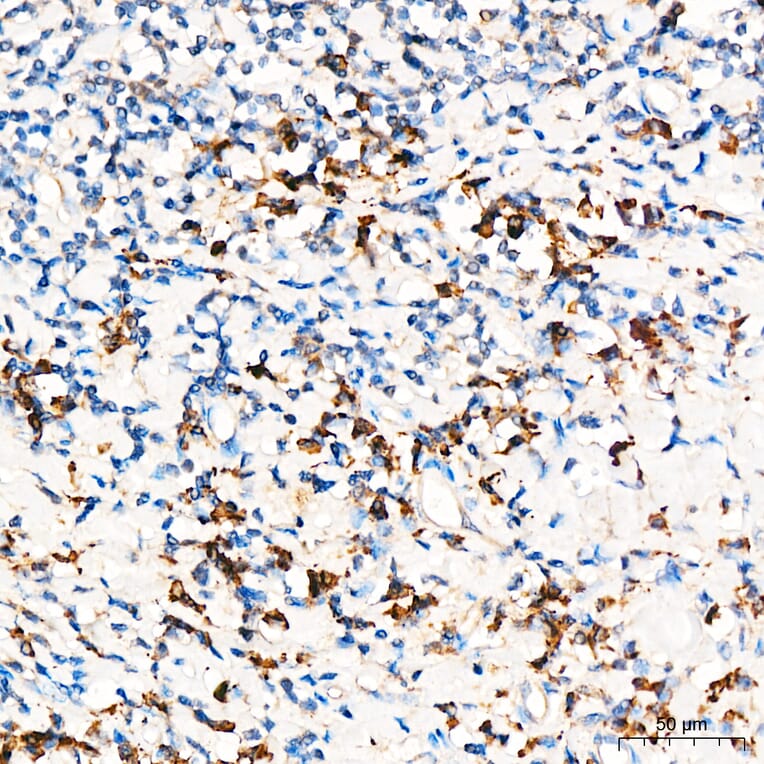 Immunohistochemistry - Anti-PRELID1 Antibody (A329773) - Antibodies.com