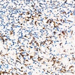 Immunohistochemistry - Anti-PRELID1 Antibody (A329773) - Antibodies.com