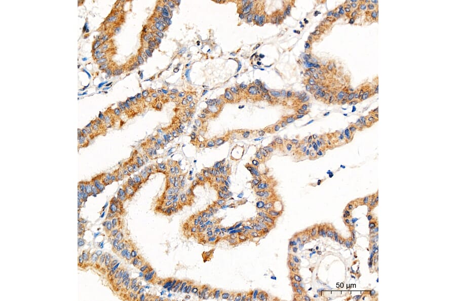 Immunohistochemistry - Anti-PRELID1 Antibody (A329773) - Antibodies.com