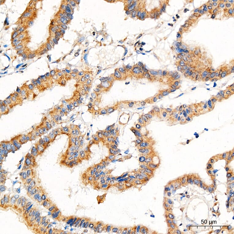 Immunohistochemistry - Anti-PRELID1 Antibody (A329773) - Antibodies.com