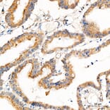 Immunohistochemistry - Anti-PRELID1 Antibody (A329773) - Antibodies.com