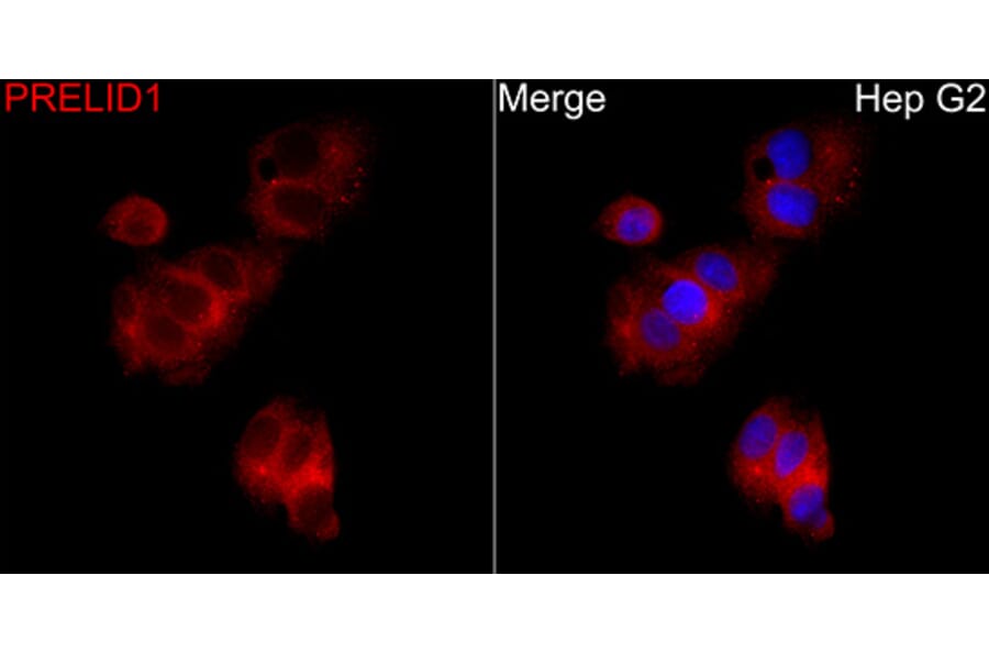 Immunofluorescence - Anti-PRELID1 Antibody (A329773) - Antibodies.com