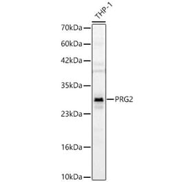 Western Blot - Anti-PRG2 Antibody (A329777) - Antibodies.com