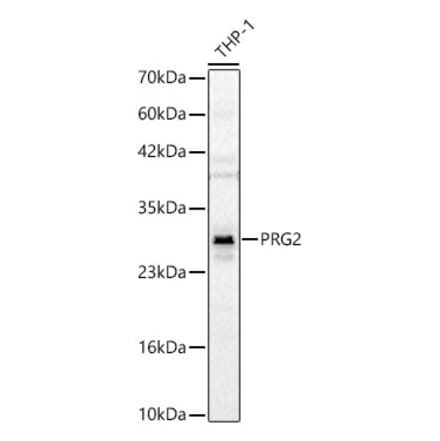 Western Blot - Anti-PRG2 Antibody (A329777) - Antibodies.com
