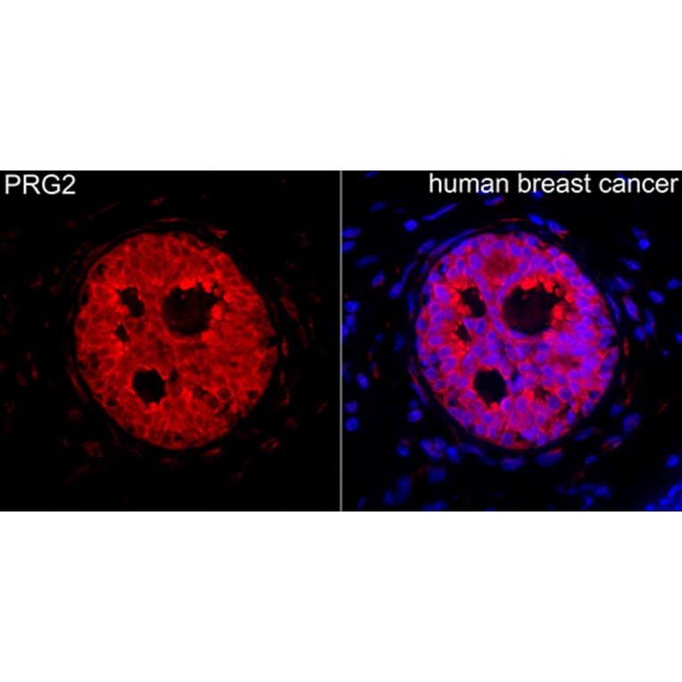 Immunofluorescence - Anti-PRG2 Antibody (A329777) - Antibodies.com